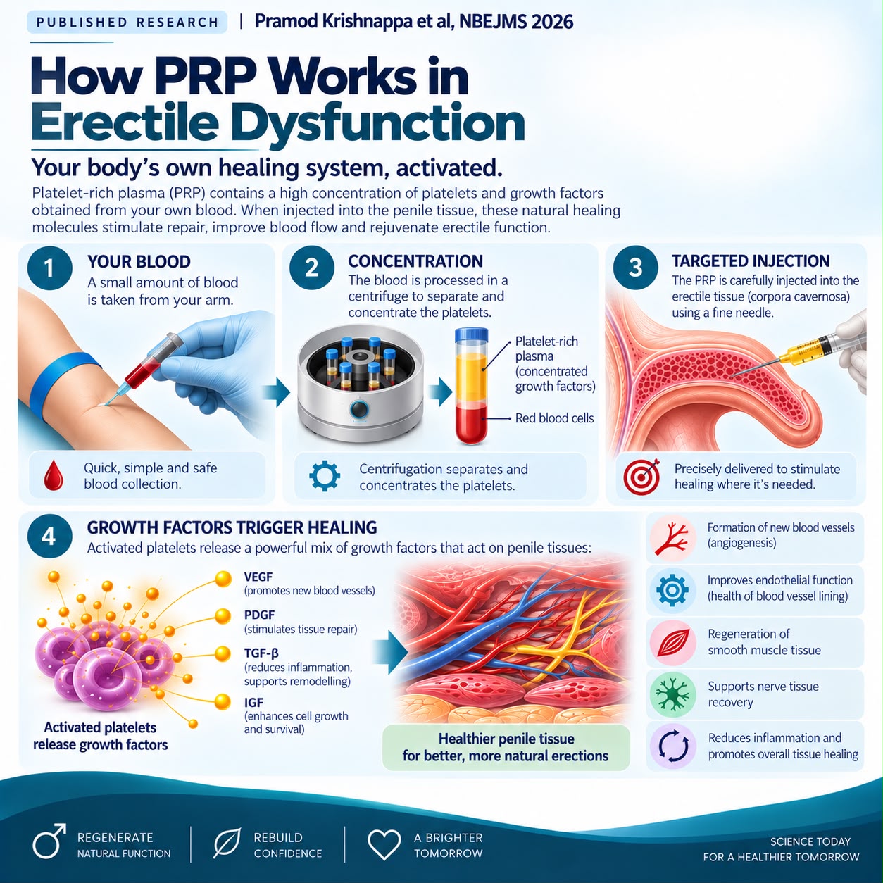 Autologous Platelet-Rich Plasma Penile Injection After Failed Oral Medical Management of Erectile Dysfunction